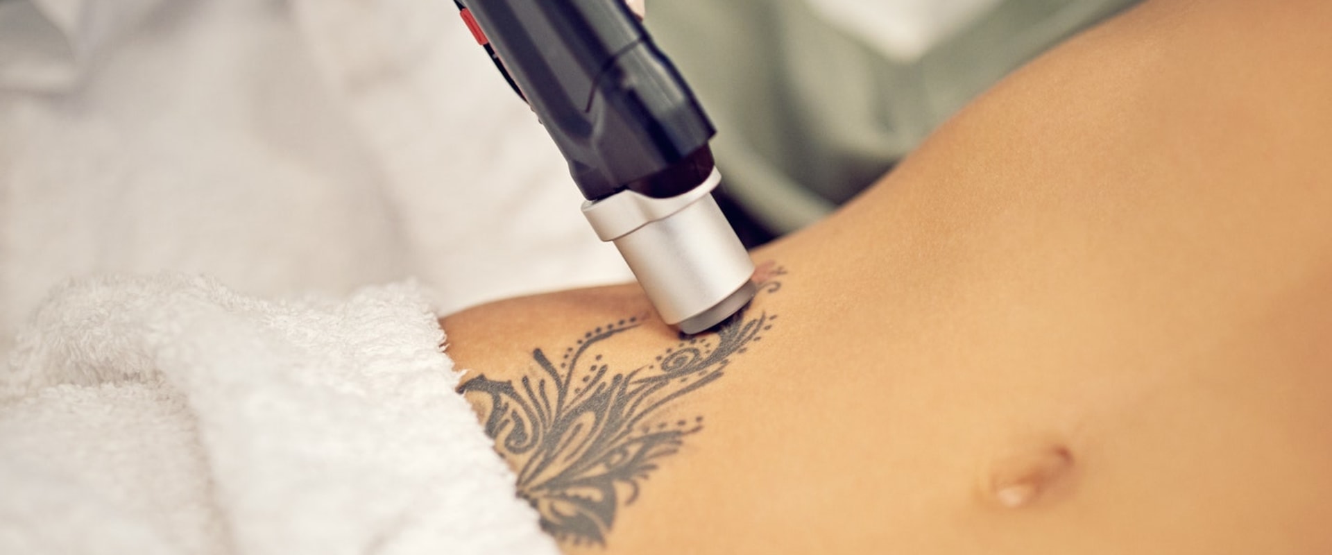 A Comprehensive Guide to Tattoo Removal: Cost, Risks, and Alternatives