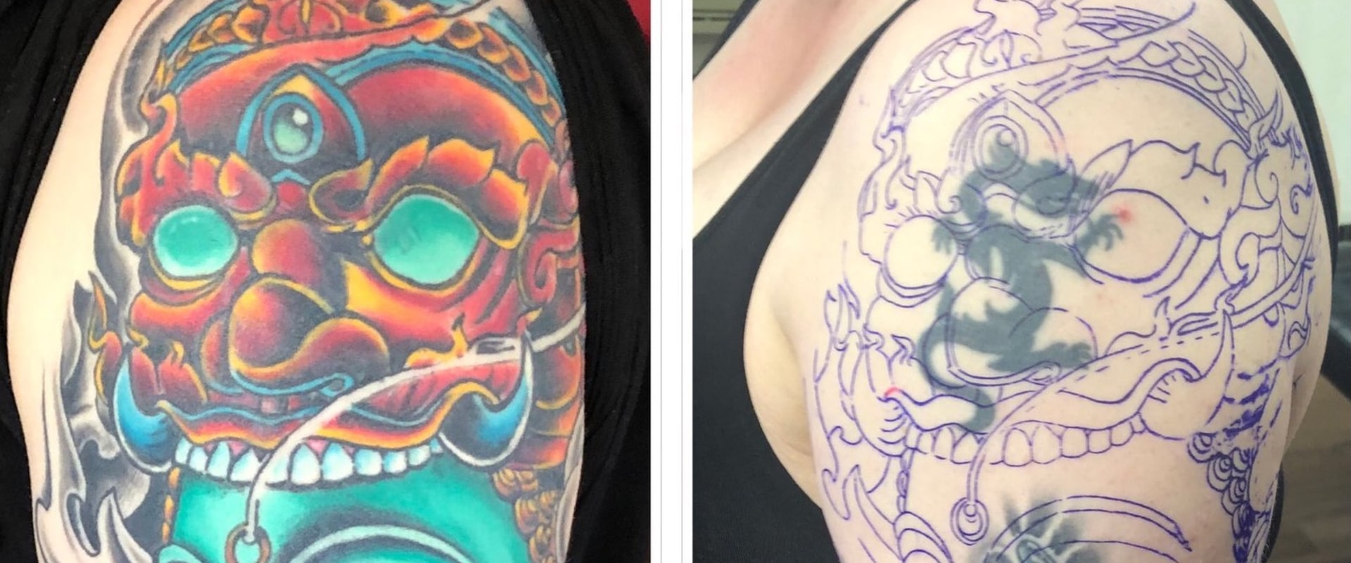 Design Considerations for Cover Up Tattoos: How to Get Rid of Unwanted Ink