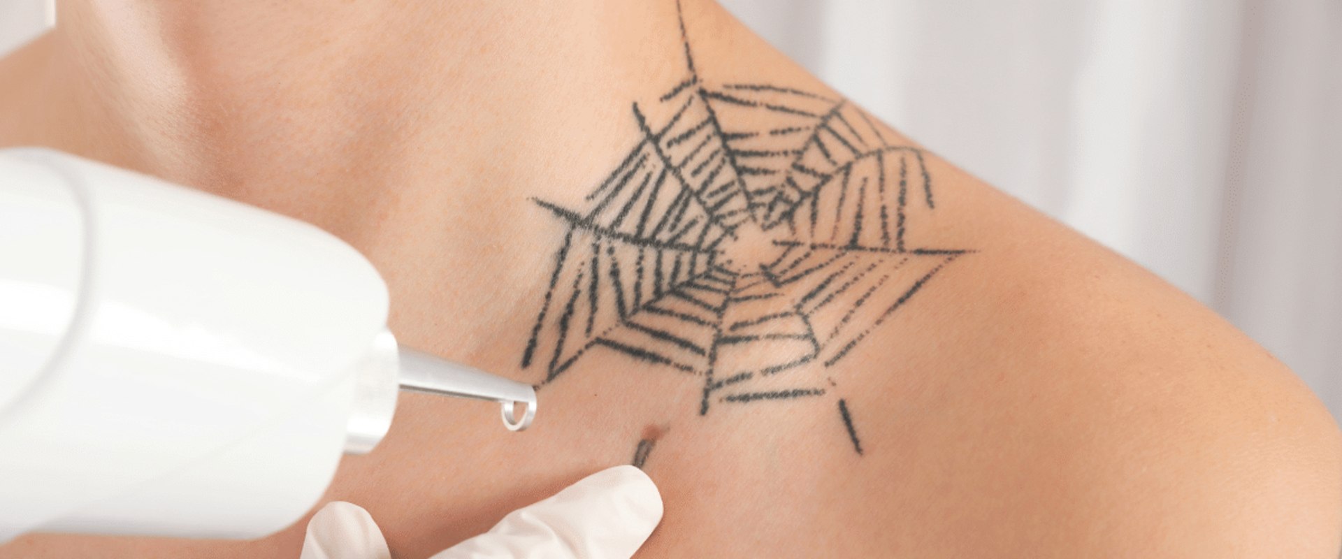 A Comprehensive Guide to Understanding Potential Risks and Complications of Tattoo Removal