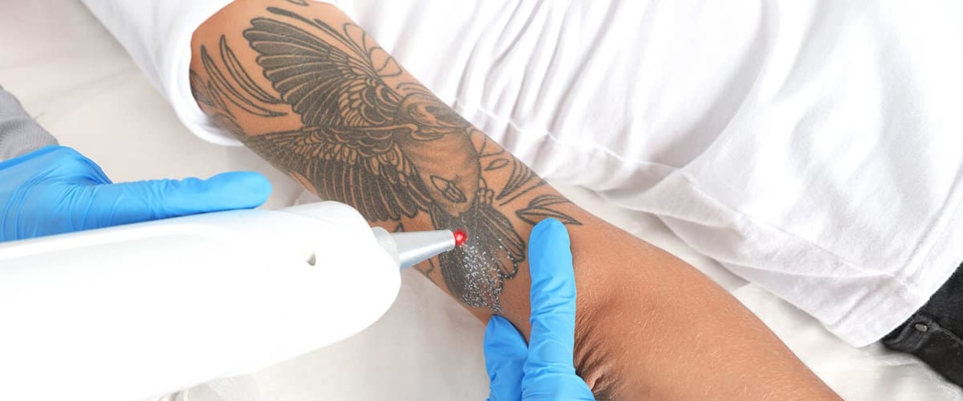 The Importance of Following Aftercare Instructions for Tattoo Removal