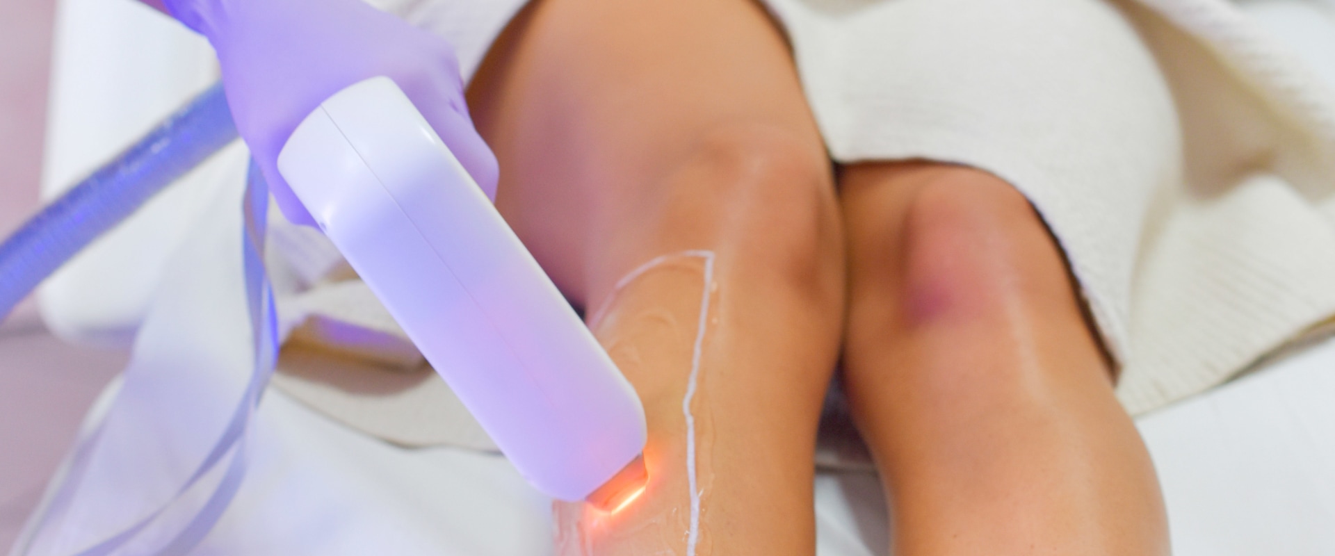 Pros and Cons of IPL Removal: What You Need to Know