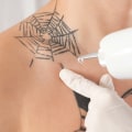 A Comprehensive Guide to Understanding Potential Risks and Complications of Tattoo Removal