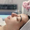 Understanding Dermabrasion: A Comprehensive Guide