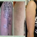 Layering Techniques for Coverage: How to Effectively Remove Unwanted Tattoos