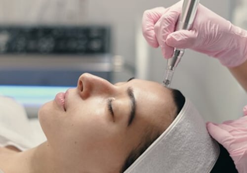 Understanding Dermabrasion: A Comprehensive Guide